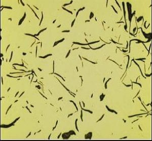 Pearlitic matrix with less than 3% ferrite and evenly distributed phosphides eutectics